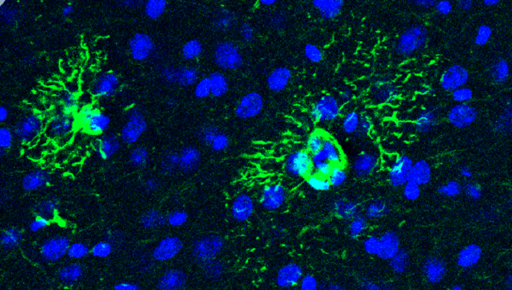 Dos atrocitos (en verde), con sus características prolongaciones en forma de estrella. La sobreproducción de una proteína por parte de estas células está relacionada con el desarrollo de Alzhéimer.