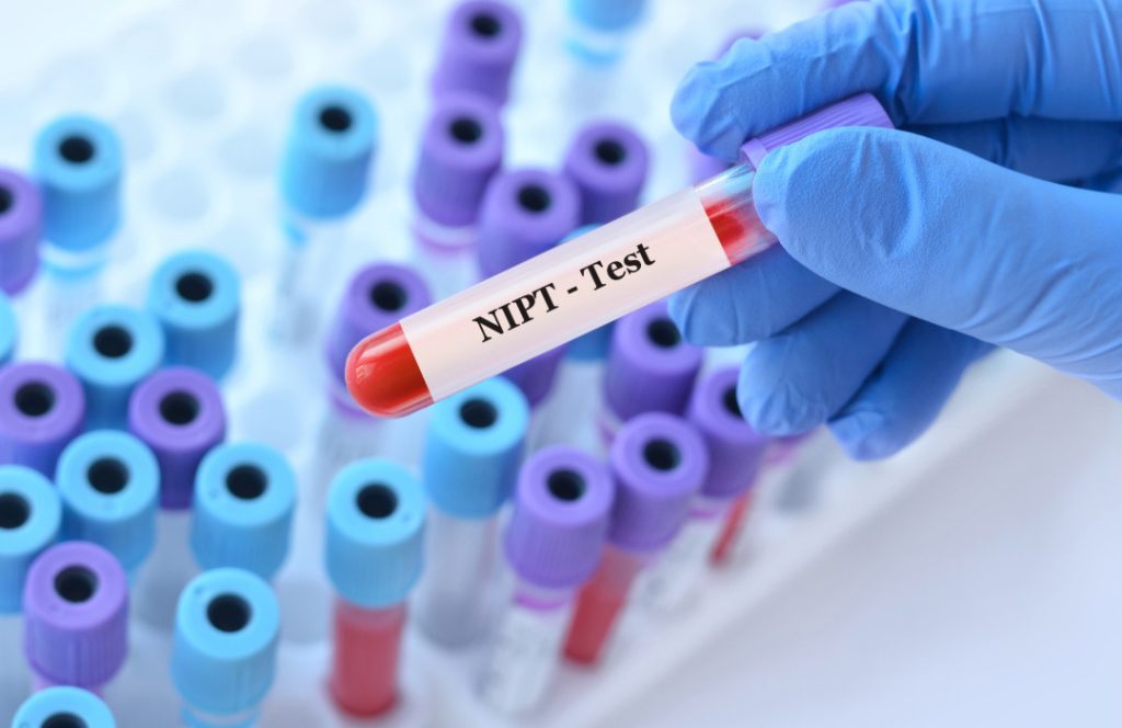 El NIPT es una prueba que analiza el ADN de origen fetal en la sangre materna