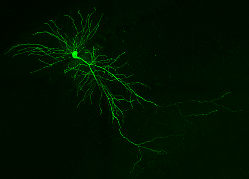 Neuronas de ratón sanas en el hipocampo. Cuando el microexón
de nueve letras se excluye de la proteína DAAM1, las neuronas forman menos conexiones con otras células.
Crédito: Patryk Poliński/Centro de Regulación Genómica.