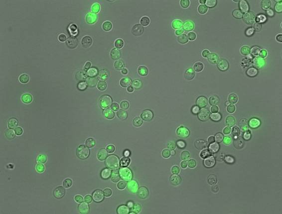 Una IA española descifra el lenguaje de la agregación de proteínas pegajosas.