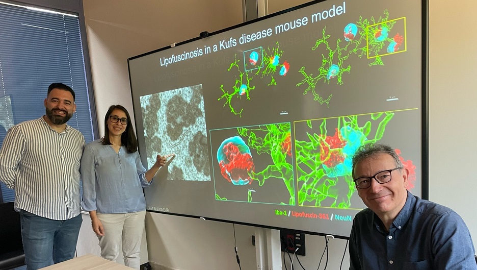 De izquierda a derecha: el Dr. Santiago López-Begines y la Dra. Nozha Borjini, junto con el director del estudio, el Prof. Rafael Fernández-Chacón, presentan las principales características patológicas observadas en el modelo murino de la enfermedad de Kufs/CLN4.