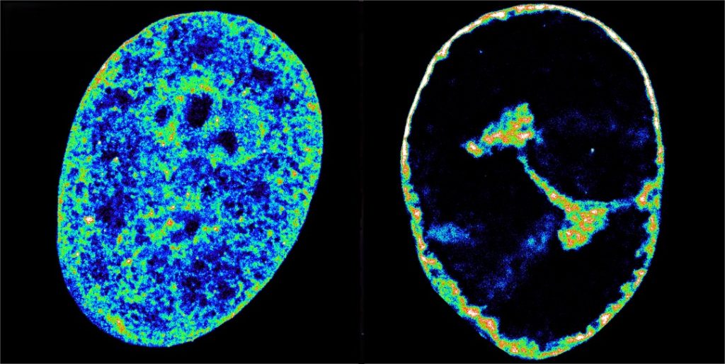 El virus del herpes modifica la organización del genoma humano para favorecer su multiplicación.