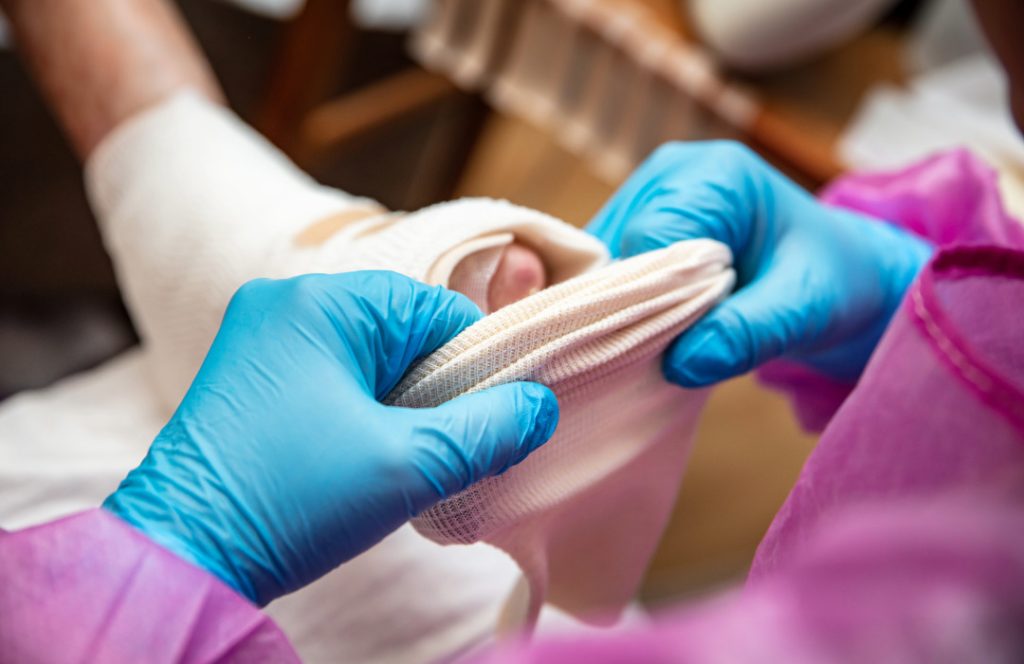 El tratamiento de la epidermólisis ampollosa distrófica recesiva se basaba, hasta hace poco, en los cuidados paliativos. El desarollo de terapia génica como ZEVASKY supone un avance muy importante para los pacientes.