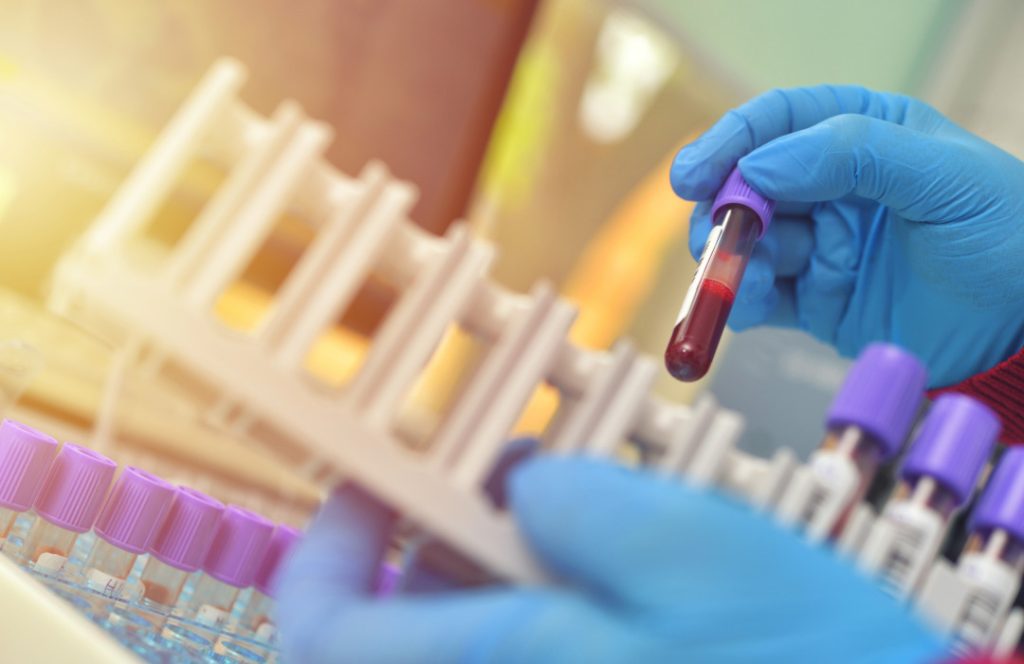 Un estudio plantea que se podría detectar la enfermedad de Lafora en un análisis simple de sangre