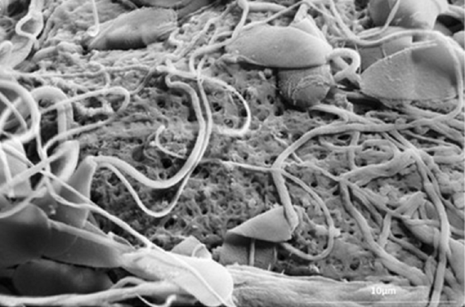 Espermatozoides sobre óvulo mostrando poros de capa externa reducidos por accion de la proteína oviductina