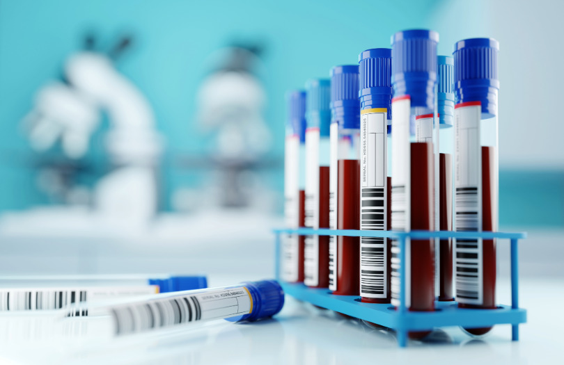 El nuevo biomarcador de Alzheimer podría identificar personas con la enfermedad en muestras de sangre, una aproximación más accesible para aplicaciones clínicas y de investigación. Imagen: Adobe Express.