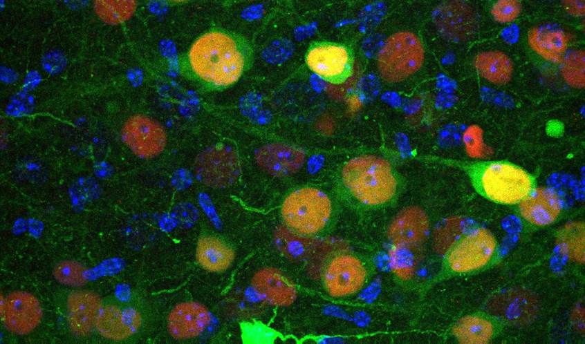 identifican un grupo de neuronas implicado en la regulación de la ansiedad