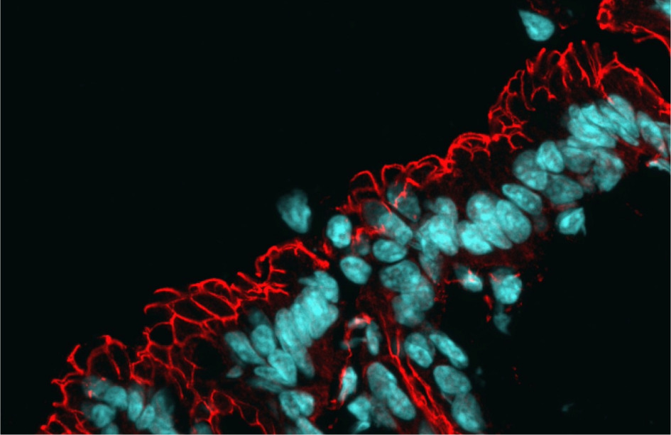 Microscopía del intestino, con los núcleos teñidos en azul y la red de proteínas de barrera en rojo. La alteración de la microbiota intestinal está conectada con el envejecimiento / Manuel Montero Gómez de las Heras, CBM.
