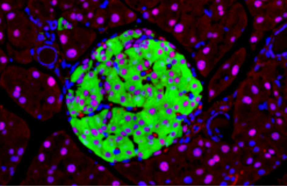 Imagen de células pancreáticas, en modelos de ratón. Un reciente estudio conecta la alteración del procesado del ARN en estas células con la diabetes tipo 2.