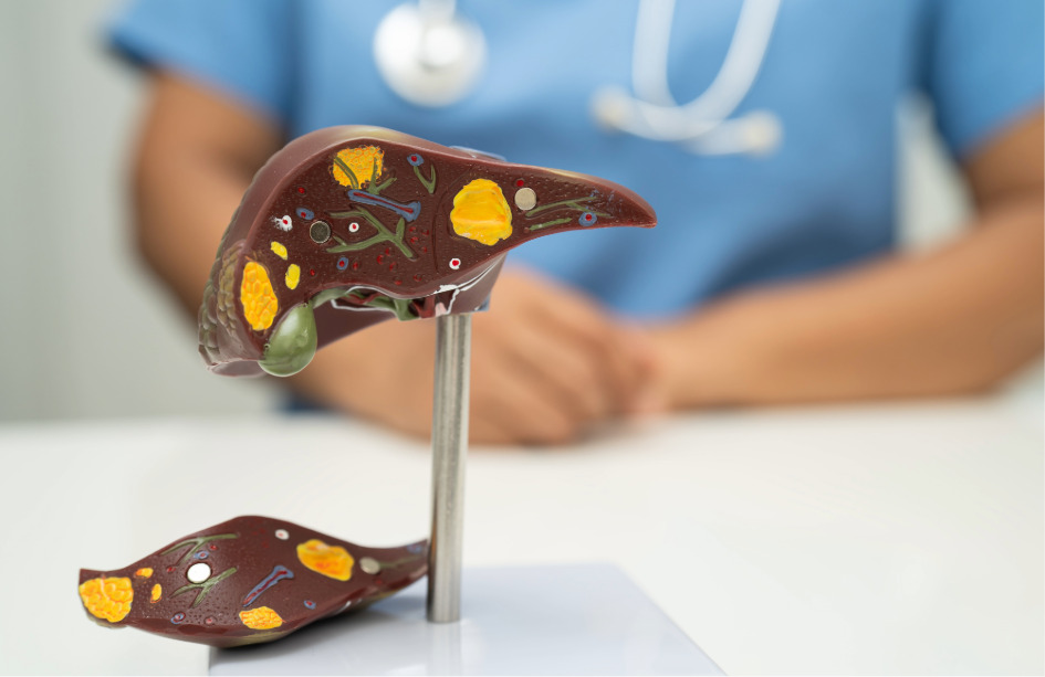 El estudio revela el papel de la ruta de TGF-B e identifica dos nuevas dianas terapéuticas para el colangiocarcinoma. 
