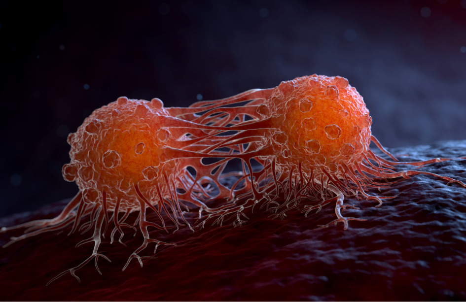 Mecanismo de resistencia a inmunoterapia en cáncer colorrectal