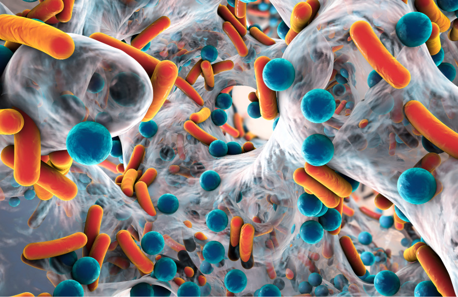 Bacterias presentes en los tumores cerebrales pueden influir en su desarrollo y respuesta a tratamiento.