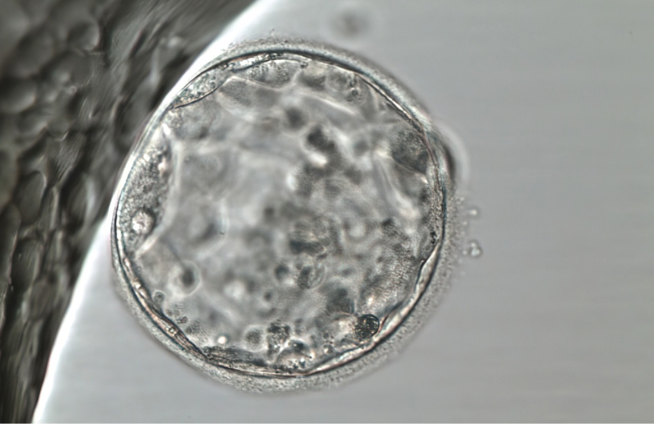 El diagnostico genético preimplantacional podría descartar embriones viables.