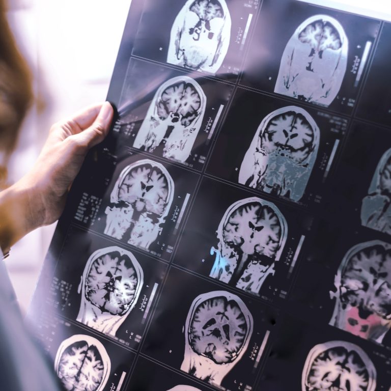 qué es la neurogenética