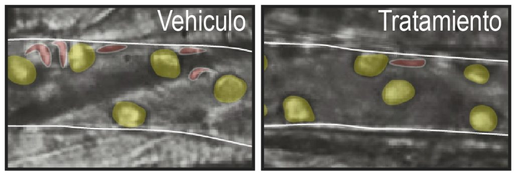 Protección contra oclusiones de los vasos sanguíneos en animales con anemia falciforme tras el tratamiento con inhibidores del reloj circadiano. Las paredes de los vasos aparecen como líneas blancas, los neutrófilos en amarillo y eritrocitos atrapados por los neutrófilos en rojo. CNIC/ Lidiane Torres.