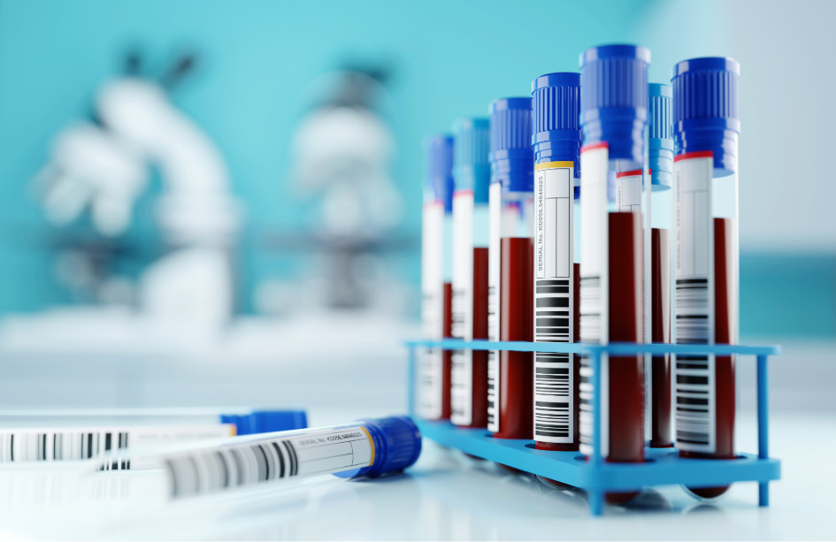 Un análisis de sangre permite detectar de forma temprana el Párkinson.