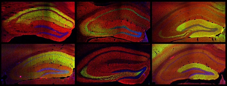 Imagenes del hipocampo, región cerebral relacionada con la memoria donde se han estudiado las sinapsis, en diferentes tinciones. Imagen: Institut de Recerca Sant Pau.