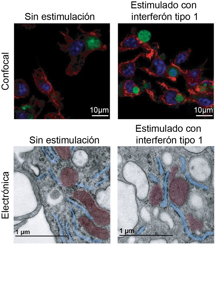 Información sobre el nuevo mecanismo de inflamación identificado