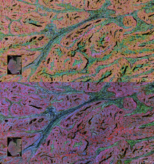 Las ómicas espaciales utilizan proteómica y transcriptómica proporcionan un mapa de la actividad biológica con resolución espacial. Imagen: IRB Barcelona.