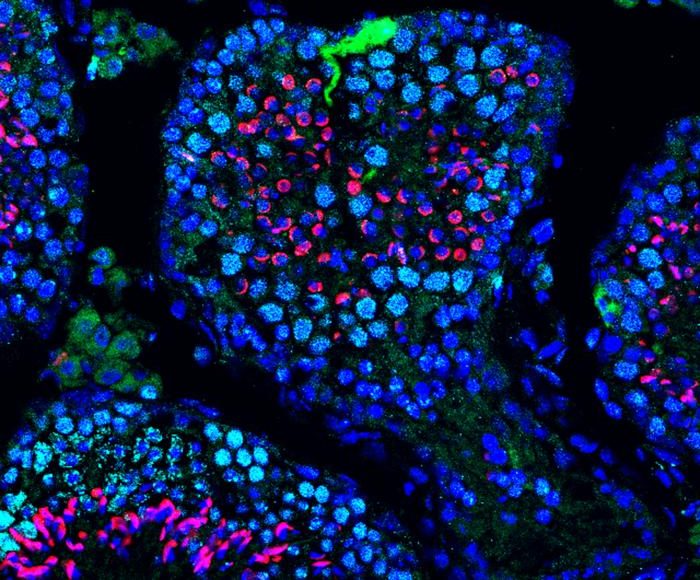 Una terapia basada en ARN mensajero recupera la producción de espermatozoides en ratones con infertilidad.