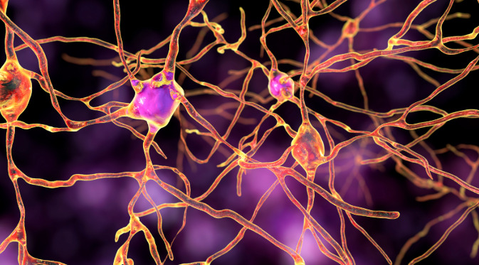 La variación genética en el gen RUNX1 influye en la respuesta a opioides.