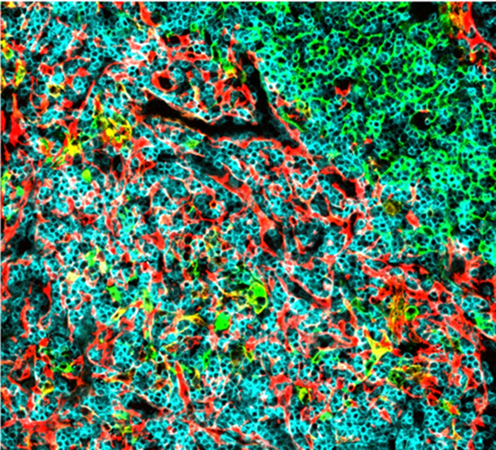 Imagen del microambiente del timo, donde se inicia la leucemia linfoblástica aguda de células T, analizado por inmunofluorescencia de detección múltiple. Una investigación ha identificado un grupo de microARNs relacionados con el desarrollo de los linfocitos T.