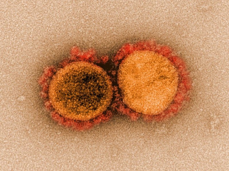 Partículas de coronavirus aisladas de un paciente. Un reciente estudio ha recreado la evolución del coronavirus responsable de COVID-19