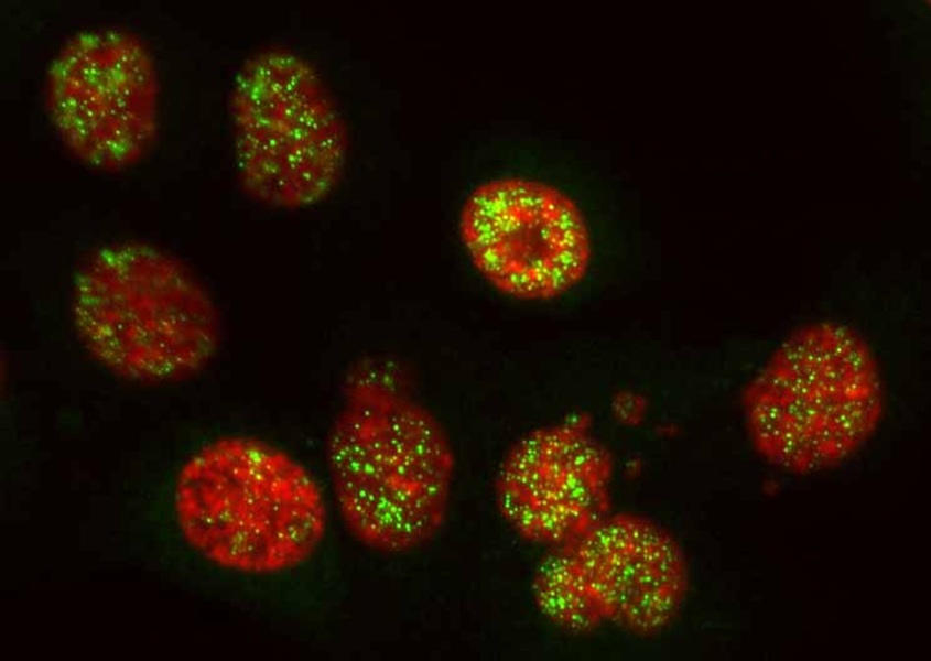 El bloqueo de la proteína PARP2 facilita la eliminación de las células tumorales y activar el sistema inmunitario frente al cáncer de páncreas.