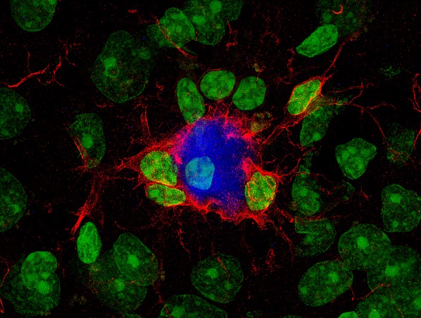 La microglía (rojo) responde al tratamiento reduciendo las placas amiloideas (azul) características del alzhéimer y protegiendo a las neuronas. Los núcleos celulares se muestran en verde. Imagen: IN (CSIC-UMH).