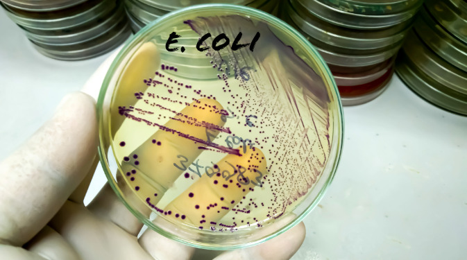 Los investigadores han desarrollado bacterias probióticas para tratar la diabetes.