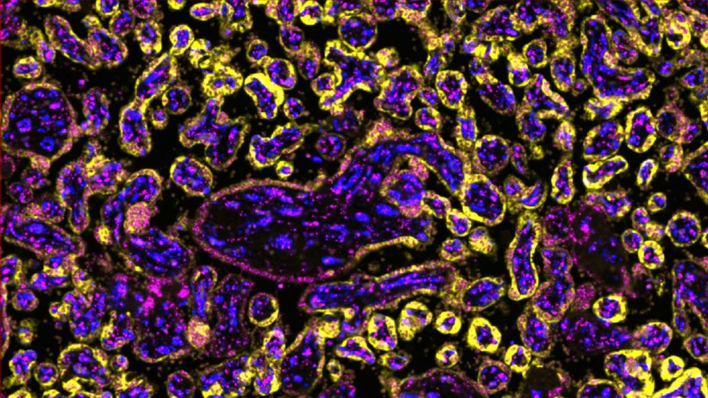 Imagen del tejido de la placenta con TRPV2 marcado, cortesía del equipo de investigación. 