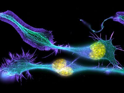 Células nerviosas en desarrollo. Imagen: Torsten Wittmann, University of California, San Francisco CC BY NC 2.0 (https://creativecommons.org/licenses/by-nc/2.0/).