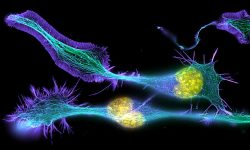 Células nerviosas en desarrollo. Imagen: Torsten Wittmann, University of California, San Francisco CC BY NC 2.0 (https://creativecommons.org/licenses/by-nc/2.0/).