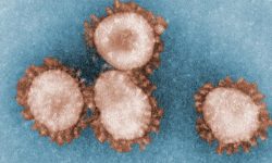 Partículas de coronavirus. Imagen: Center for Disease Control, Dr. Fred Murphy; Sylvia Whitfield