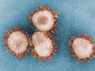 Partículas de coronavirus. Imagen: Center for Disease Control, Dr. Fred Murphy; Sylvia Whitfield