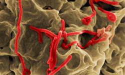 Partículas víricas de Ébola. Imagen: Center for Disease Control and Prevention. National Institute of Health, EEUU.