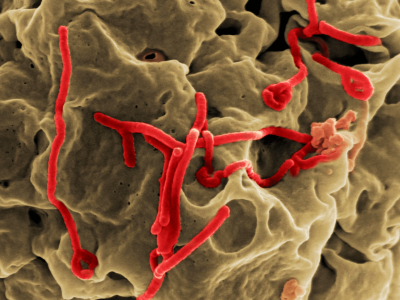 Partículas víricas de Ébola. Imagen: Center for Disease Control and Prevention. National Institute of Health, EEUU.
