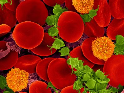 Las plaquetas, en verde en la figura, tienen la capacidad de absorber proteínas o moléculas de ARN de los tumores.  Dennis Kunkel. Microscopy, Inc. (NIH Image and Video Gallery).