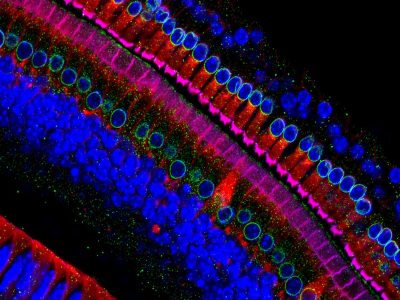 Células sensoriales del oído. Imagen: Henning Horn, Brian Burke and Colin Stewart, Institute of Medical Biology, Agency for Science, Technology, and Research, Singapore.