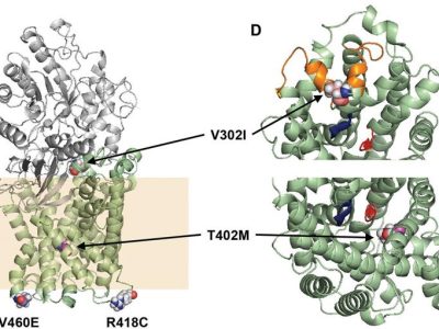 Localización de algunas de las mutaciones identificas en la estructura molecular de SLC7A8. Imagen: Espino Guarch et al. https://doi.org/10.7554/eLife.31511.014.