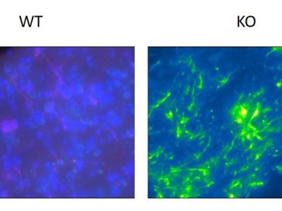 Infiltración de células de la glía, marcadores de neuroinflamación en el modelo murino de síndrome de Rett en KO (deficientes para la proteína Mecp2) y WT (ratones salvajes para la proteína Mecp2). Imagen Jorge-Torres OC, Casal Moreno C. microscopio ZEISS. PEBC, Idibell.