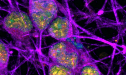 Neuronas (coloreadas en morado) con signos de reparación del ADN activa (coloreada en amarillo). La superposición entre el ADN (coloreado en azul) y la reparación del ADN se muestra en color verde. Imagen del Instituto Nacional de Trastornos Neurológicos y Accidentes Cerebrovasculares (NINDS, por sus siglas en inglés).