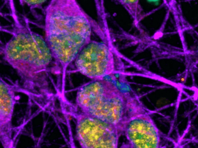 Neuronas (coloreadas en morado) con signos de reparación del ADN activa (coloreada en amarillo). La superposición entre el ADN (coloreado en azul) y la reparación del ADN se muestra en color verde. Imagen del Instituto Nacional de Trastornos Neurológicos y Accidentes Cerebrovasculares (NINDS, por sus siglas en inglés).