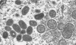Viriones de virus de la viruela del mono en una muestra clínica de piel humana obtenida en un brote de 2003 y observada mediante microscopía electrónica. A la izquierda se observan partículas víricas maduras y a la derecha viriones inmaduros. Imagen:  Cynthia S. Goldsmith, Russell Regnery, Center for Disease Control.