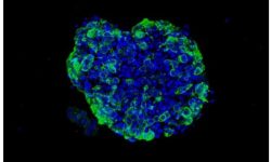 Ejemplo de organoide de células tumorales. Imagen: Laboratorio de Eduard Batlle.