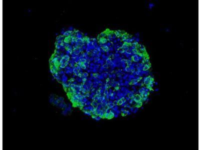 Ejemplo de organoide de células tumorales. Imagen: Laboratorio de Eduard Batlle.