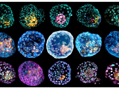 Imágenes de diferentes tinciones de los blastoides. Imagen: Monash University.