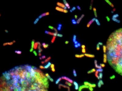 La presencia de ALDH2 y  la ruta de resparación del ADN responsable de la anemia de Fanconi es esencial para evitar la inestabilidad en el genoma y rotura de cromosomas. Imagen: Thomas Ried, NCI Center for Cancer Research, National Cancer Institute, National Institutes of Health.