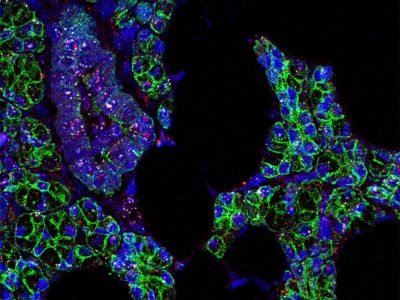 El ARN del virus SARS-CoV-2 (en rosa) y el receptor ACE2 están presentes en células de las glándulas salivales humanas (marcadas en verde). Imagen:  Paola Perez, PhD, Warner Lab, Instituto Nacional de Investigación Dental y Craneofacial.