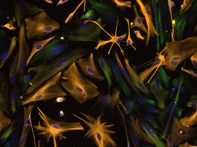 Cultivo de astrocitos, en los que se ha realizado una tinción con proteína GFAP.  Imagen: Carol Ibe, Eugene Major, National Institute of Neurological Disorders and Stroke, National Institutes of Health.